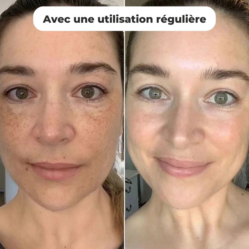 Lumeor – Masque au Collagène BIO, le Secret Coréen